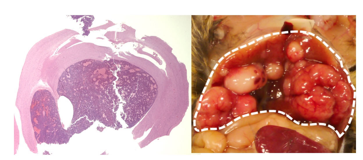 図2 RB1機能を抑えることによって生じた脳腫瘍（左）と肝臓がん（右）。