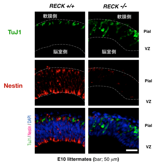 RECKノックアウトマウスの大脳において観察された神経前駆細胞の早熟分化。
RECK活性の消失は、Notchリガンドの過剰なシェディングを生じるために、
Notchシグナルを減弱させる。
この表現型は、Notchシグナルが途絶したマウスのそれとそっくりである。